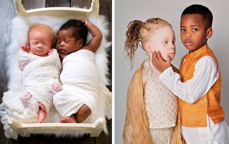 Близнецы разного цвета кожи фото