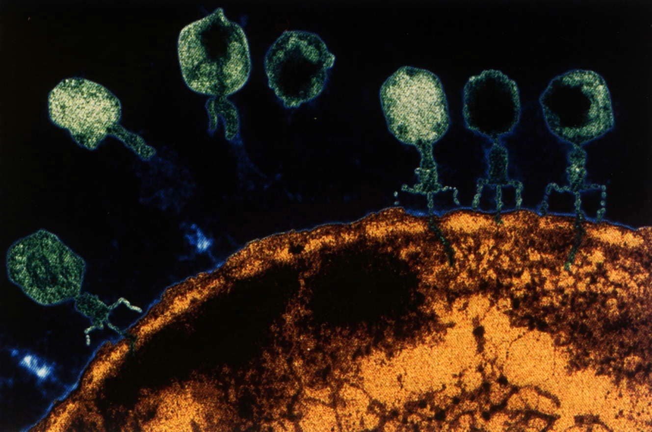Бактериофагия. Вирус бактериофаг под микроскопом. Бактериофаг т5. Вирус бактериофаг микроскоп. Бактериофаг т4 под микроскопом.